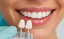Clareamento Dental